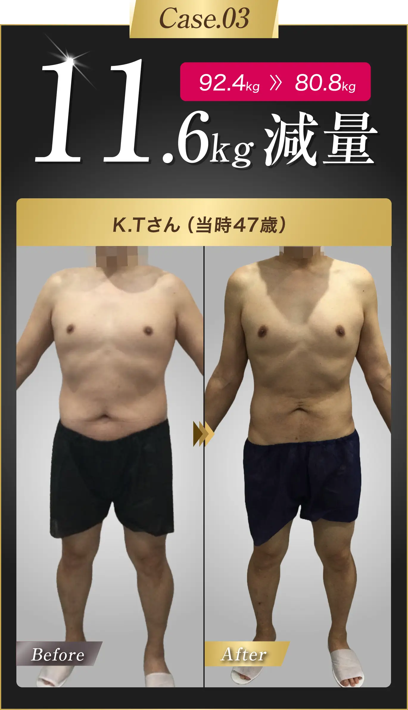 2人目 IM様 当時36歳 9.1kg減量成功!
