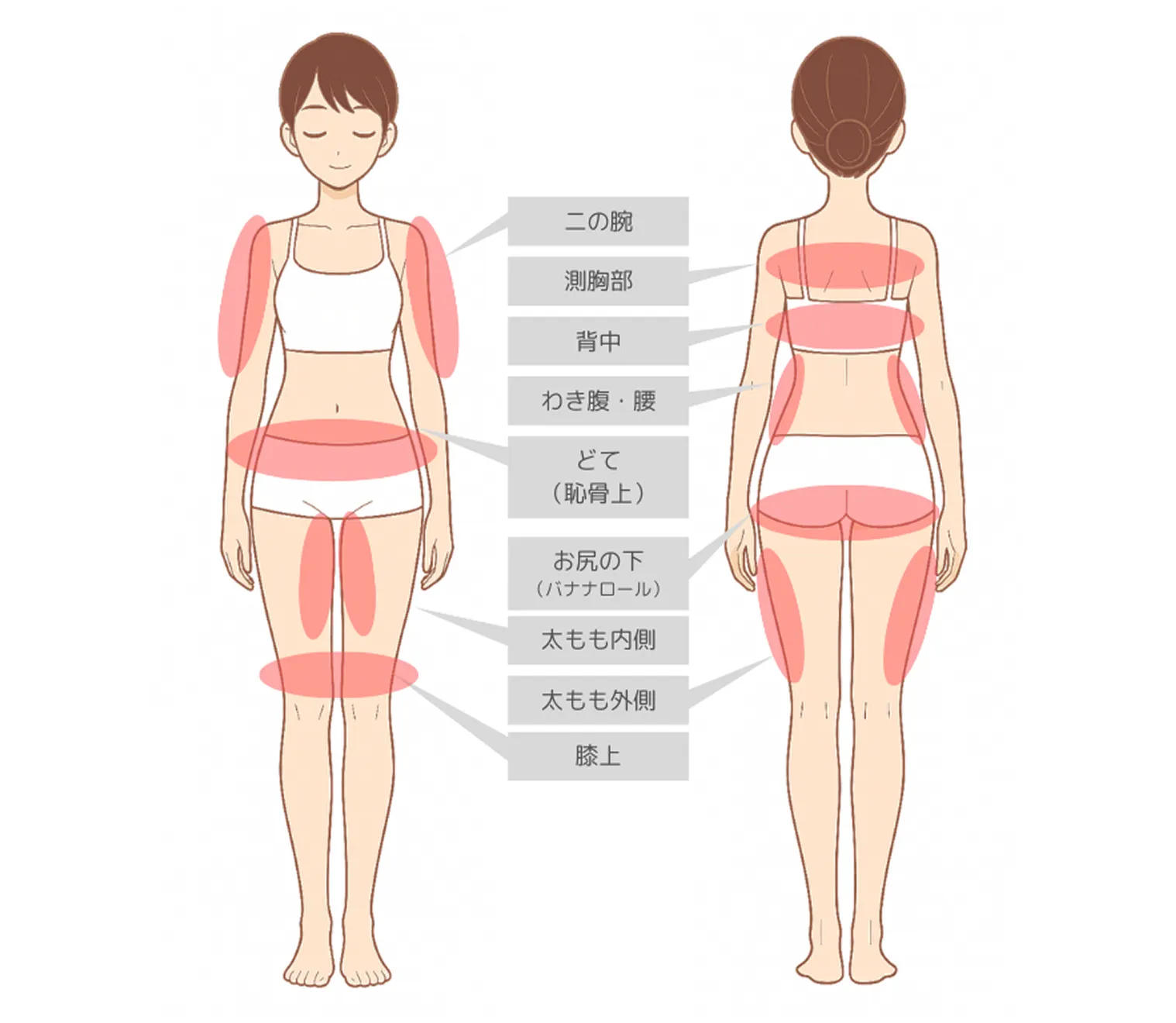 脂肪冷却の適応部位