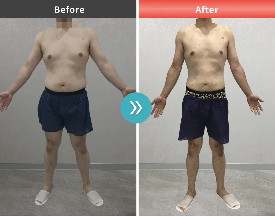 医療痩身・医療ダイエットの症例No.0074｜89.3kg→74.4kg（40代男性・173cm）