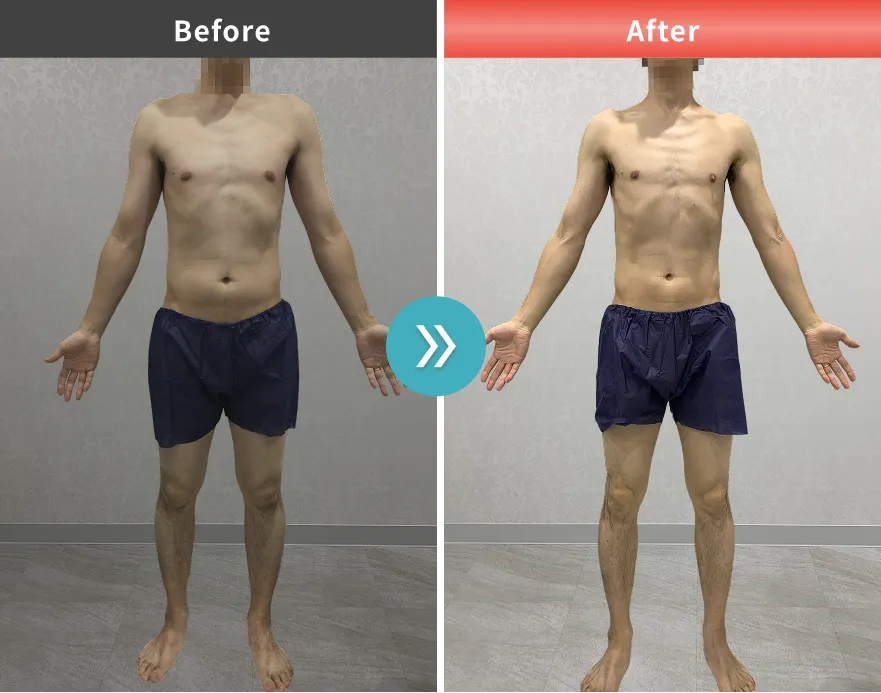 医療痩身・医療ダイエットの症例No.0077｜84.6kg→75.5kg（40代男性・183cm）