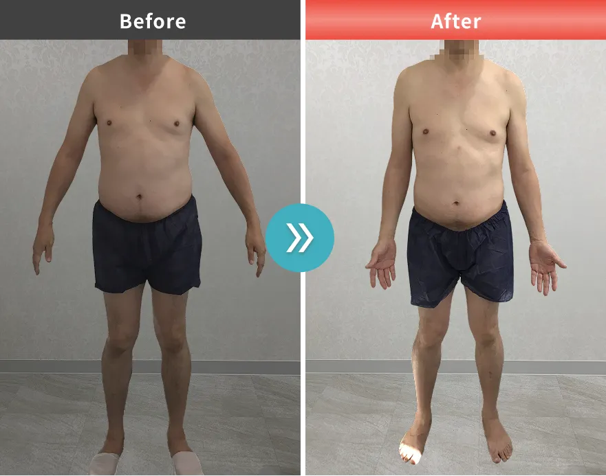 医療痩身・医療ダイエットの症例No.0078｜85.7kg→79.6kg（40代男性・178cm）