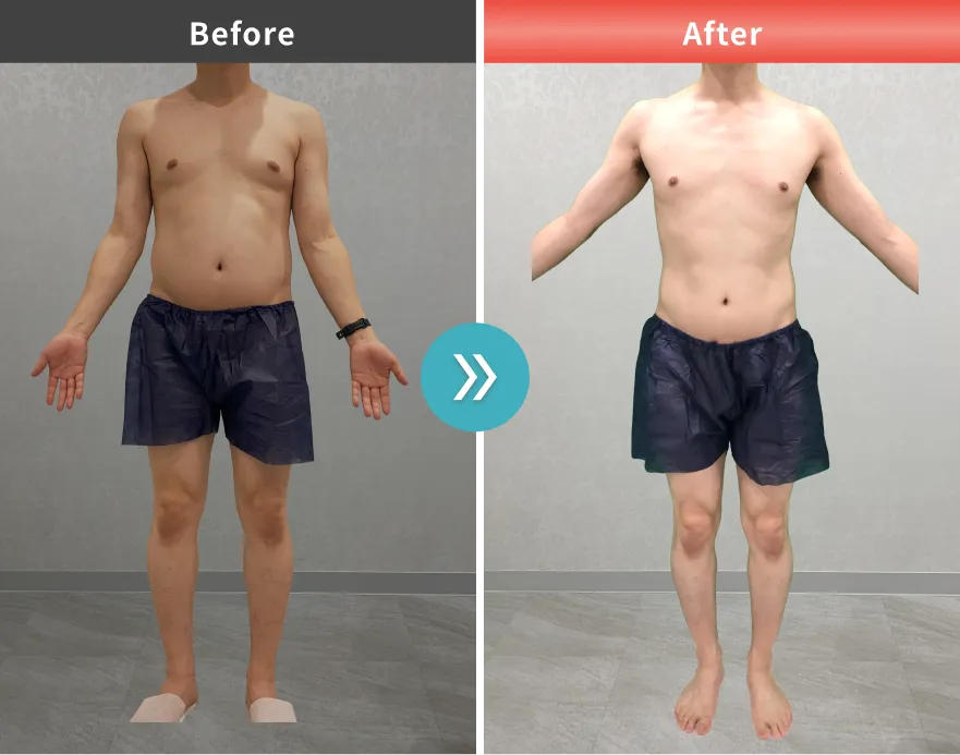 症例No.00005｜96.1kg→75.8kg（40代男性・176cm）