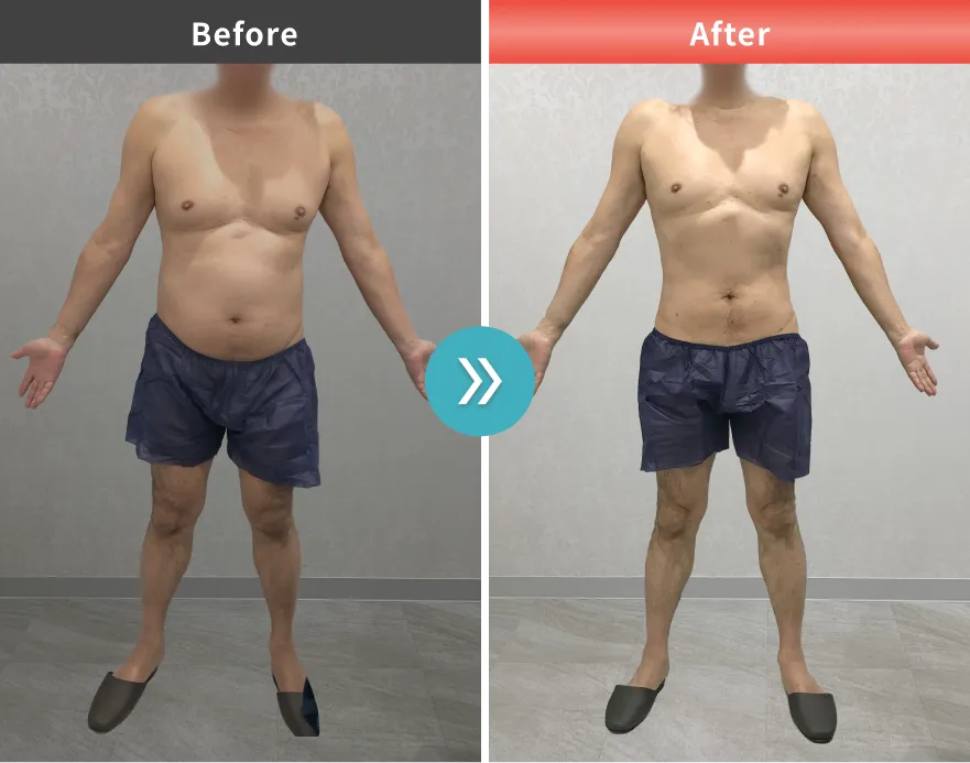 症例No.00142｜85.5kg→77.9kg（60代男性・173cm）