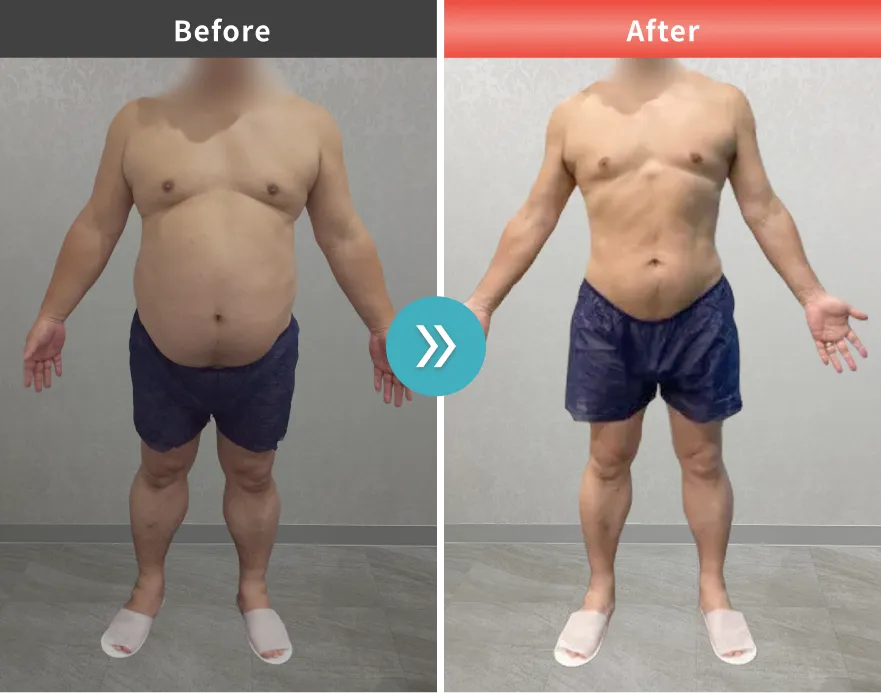 症例No.00168｜107.9kg→79.0kg（50代男性・168cm）