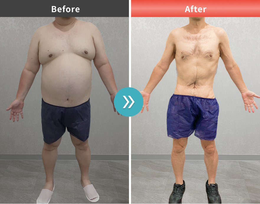 症例No.00178｜112.7kg→59.7kga【木村昌夫様】（50代男性・167cm）