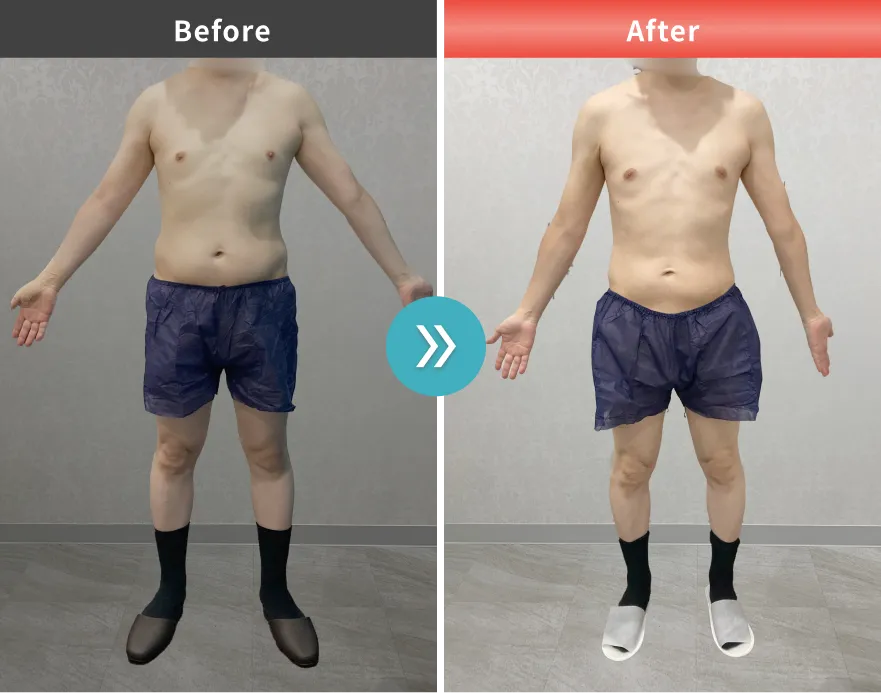 症例No.00180｜80.5kg→65.6kg（40代男性・177cm）
