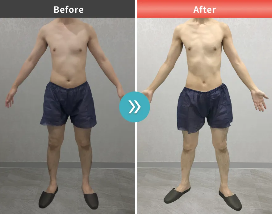 症例No.00181｜68.2kg→57.7kg（30代男性・174cm）